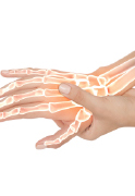手の外科（手や指の疾患と治療、リハビリテーション）
